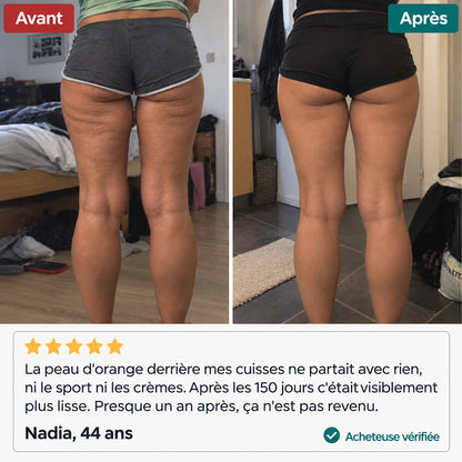 Lynae - Drainant Lymphatique - Cellulite
